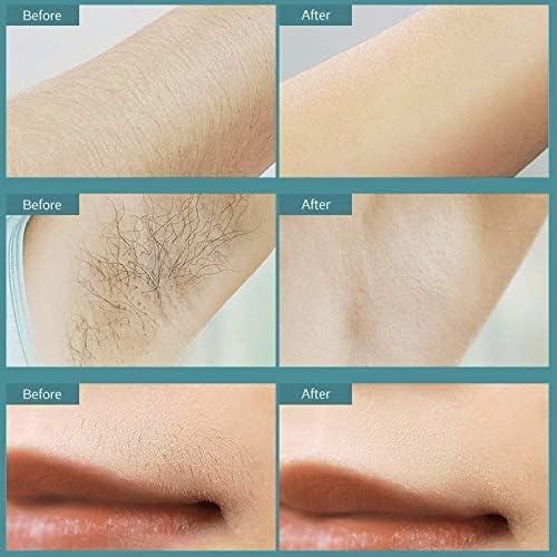 Laser Hair Removal Device for Women & Men