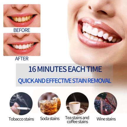 Portable Teeth Whitening Lamp with Enhanced Cold Light Gel Removes Yellow Stains from Teeth a Miracle of Oral Whitening Care
