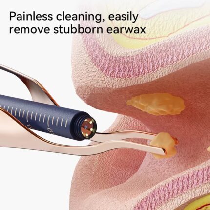 Smart Visual Ear Wax Cleaner With Camera 800W HD Endoscope