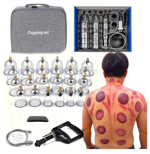 24PCS Vacuum Cupping Massage Set