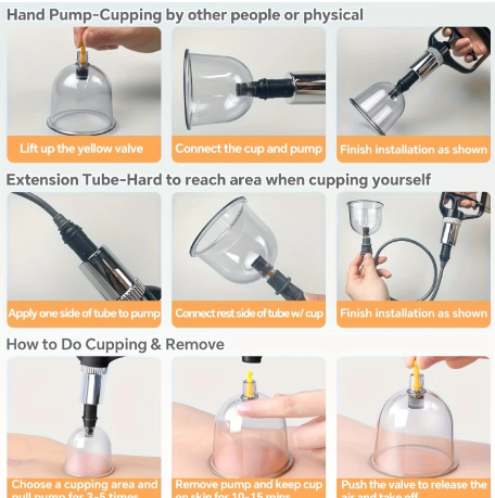 24PCS Vacuum Cupping Massage Set